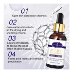 Anti Acne Whitening Facial Serum Multicolour 30ml