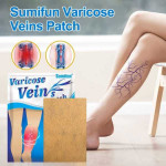 Sumifun Varicose Veins Blue Patch 8 Patches